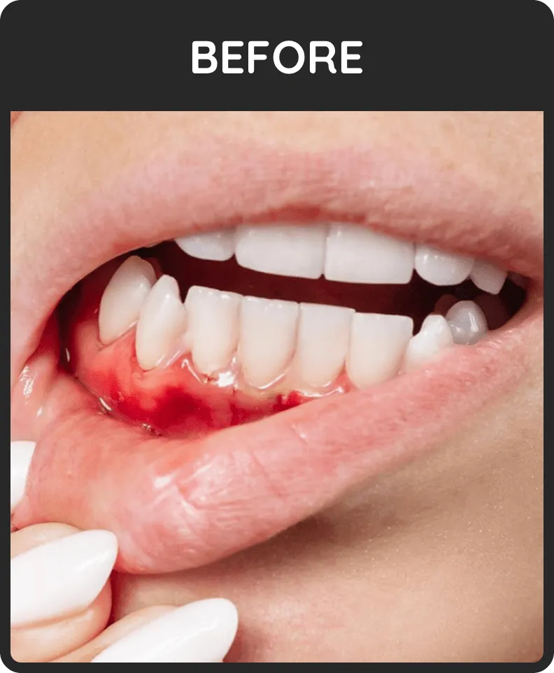 Before: bleeding gums close-up